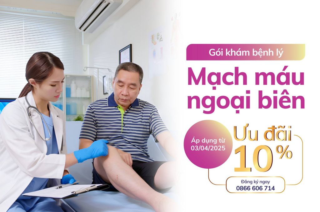 Gói khám bệnh lý mạch máu ngoại biên