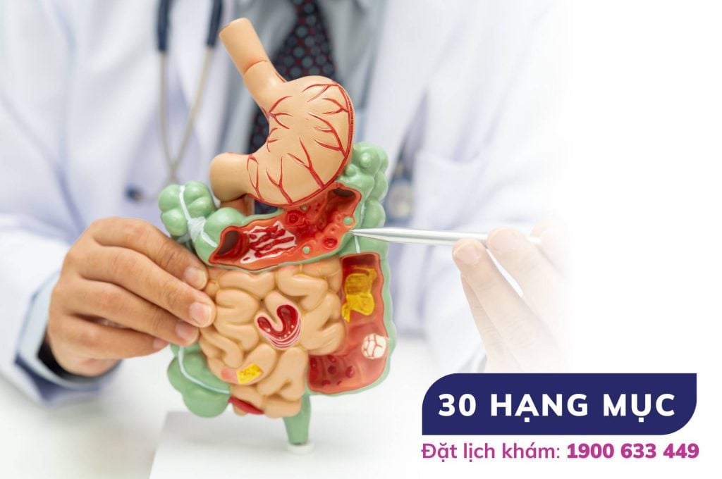 Gói tổng quát chuyên sâu – Tầm soát ung thư tiêu hóa