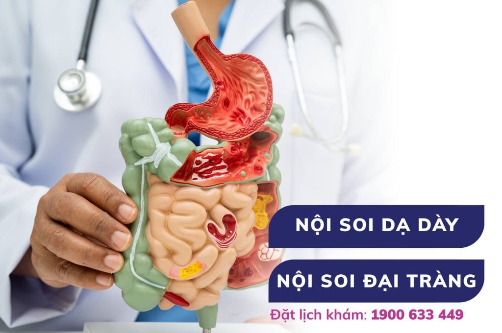 Gói tầm soát ung thư tiêu hóa