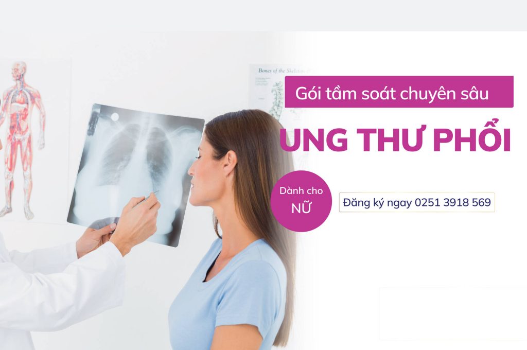 Gói khám sức khỏe tổng quát tầm soát chuyên sâu ung thư phổi dành cho Nữ
